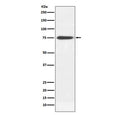 Western blot testing of human plasma lysate with Human IgM antibody. Expected molecular weight: 70-75 kDa.