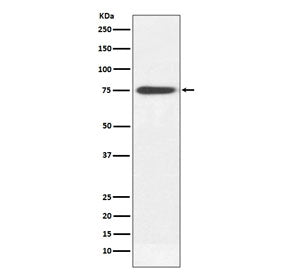 Western blot testing of human plasma lysate with Human IgM antibody. Expected molecular weight: 70-75 kDa.