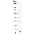 Western blot testing of human placenta lysate with DBI antibody at 0.5ug/ml. Predicted molecular weight ~10 kDa.