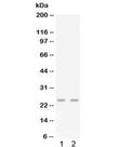 Western blot testing of 1) mouse lung and 2) mouse spleen lysate with Gro gamma antibody. Predicted molecular weight ~11 kDa, observed here at ~25 kDa.