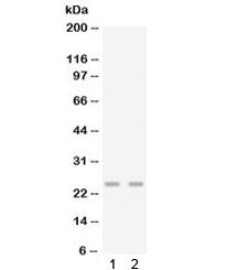 Western blot testing of 1) mouse lung and 2) mouse spleen lysate with Gro gamma antibody. Predicted molecular weight ~11 kDa, observed here at ~25 kDa.