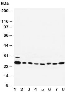 Western blot testing of Rab5 antibody and Lane 1: rat brain; 2: rat ovary; 3: human placenta; 4: HeLa; 5: 293T; 6: A375; 7: COLO320; 8: MM453 cell lysate. Predicted/observed molecular weight: ~25kDa.