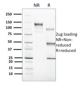 SDS-PAGE analysis of purified, BSA-free CD1c antibody (clone CD1C/1603) as confirmation of integrity and purity.
