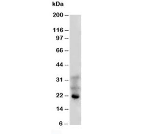 Western blot testing of FGF4 antibody and human HeLa cell lysate. Predicted molecular weight ~22 kDa.