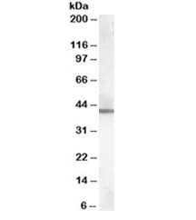 Western blot testing of mouse brain lysate with ABHD12 antibody at 0.3ug/ml. Predicted molecular weight: ~45kDa.