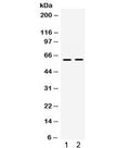 Western blot testing of 1) rat brain and 2) mouse brain lysate with PAK3 antibody. Expected/observed molecular weight ~62 kDa.
