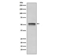 Western blot testing of human HeLa cell lysate with CHEK1 antibody. Predicted molecular weight ~54 kDa.