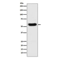 Western blot testing with Antithrombin III antibody. Predicted molecular weight ~52 kDa.