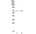 Western blot testing of human 1) MDA-MB-453 and 2) SW620 cell lysate with HDAC10 antibody at 0.5ug/ml. Predicted molecular weight ~71 kDa.