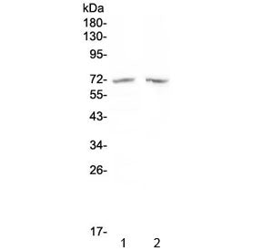 Western blot testing of human 1) MDA-MB-453 and 2) SW620 cell lysate with HDAC10 antibody at 0.5ug/ml. Predicted molecular weight ~71 kDa.