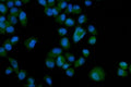 Immunofluorescent staining of FFPE human PC-3 cells with Eph receptor A3 antibody (green) and DAPI nuclear stain (blue). HIER: steam section in pH6 citrate buffer for 20 min.