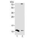 Western blot testing of human 1) spleen and 2) liver lysate with DEFA1 antibody at 1:1000. Predicted molecular weight ~10 kDa.