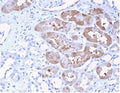 IHC staining of FFPE human kidney tissue with Fibroblast Growth Factor 23 antibody (clone FGF23/4174) at 2ug/ml in PBS for 30min RT. Negative control inset: PBS instead of primary antibody to control for secondary binding. HIER: boil tissue sections in pH 9 10mM Tris with 1mM EDTA for 20 min and allow to cool before testing.