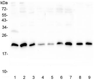 Western blot testing of human 1) placenta, 2) U-2 OS, 3) A431, 4) PC-3, 5) HL-60, 6) K562, 7) Caco-2, 8) rat lung and 9) mouse lung lysate with SRI antibody at 0.5ug/ml. Predicted molecular weight ~22 kDa, routinely observed at 22-29 kDa.