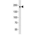Western blot analysis of lysate from A431 cell line using ZO1 antibody diluted at 1:1000.