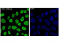 IF/ICC staining of human HeLa cells with c-Myc antibody (green) and DAPI nuclear stain (blue).
