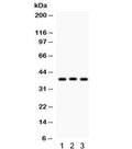 Western blot testing of 1) rat liver, 2) rat thymus and 3) human HeLa lysate with CTGF antibody. Predicted/observed molecular weight ~38 kDa.