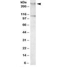 Western blot testing of human peripheral mononucleocytes lysate with Talin 1 antibody at 1ug/ml. The expected ~275kDa band and the additional ~110kDa band are blocked by the immunizing peptide.