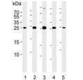 Western blot testing of human 1) HeLa, 2) HUVEC, 3) MCF7, 4) SH-SY5Y and 5) mouse lung lysate with CDKN1A antibody.