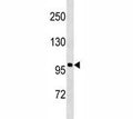Anti-Androgen Receptor antibody western blot analysis in NCI-H292 lysate. Predicted molecular weight ~99kDa.