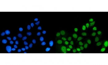 Immunofluorescent staining of FFPE human MCF7 cells with Dynein light chain 1 antibody (green) and DAPI nuclear stain (blue). HIER: steam section in pH6 citrate buffer for 20 min.