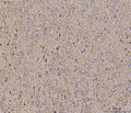 IHC staining of FFPE mouse brain tissue with Calcineurin A antibody. HIER: boil tissue sections in pH8 EDTA for 20 min and allow to cool before testing.