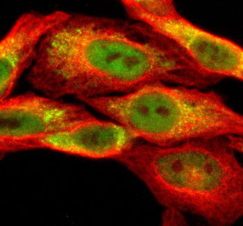 Immunofluorescent staining of SESN3 using anti-SESN3 antibody (green) and anti-Beta Tubulin antibody (red). SESN3 was detected in an immunocytochemical section of Hela cells. Enzyme antigen retrieval was performed using IHC enzyme antigen retrieval reagent for 15 mins. The cells were blocked with 10% goat serum. And then incubated with 5 ug/ml rabbit anti-SESN3 antibody and mouse anti-Beta Tubulin antibody overnight at 4oC.