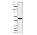 Western blot testing of human HepG2 cell lysate with Inositol-tetrakisphosphate 1-kinase antibody. Predicted molecular weight ~46 kDa.