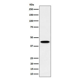 Western blot testing of human HepG2 cell lysate with Inositol-tetrakisphosphate 1-kinase antibody. Predicted molecular weight ~46 kDa.