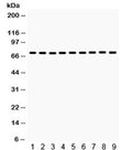 Western blot testing of 1) rat liver, 2) rat thymus, 3) rat testis, 4) mouse liver, 5) mouse kidney, 6) human HeLa, 7) human MCF7 and 8) human A375 and 9) mouse NIH3T3 lysate with HSPA2 antibody. Expected/observed molecular weight ~70 kDa.