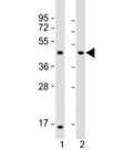 Western blot testing of 1) mouse heart and 2) rat heart lysate with LIAS antibody at 1:2000. Predicted molecular weight: 42 kDa.