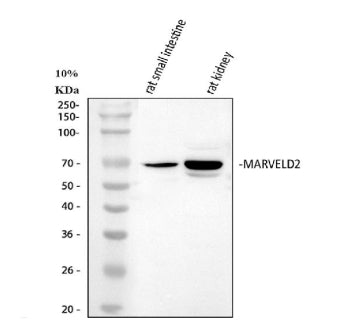 Western blot analysis of MARVELD2 using anti-MARVELD2 antibody. Lane 1: human RT4 whole cell lysates, Lane 2: human Caco-2 whole cell lysates, Lane 3: human whole cell lysates, Lane 4: human MCF-7 whole cell lysates. After electrophoresis, proteins were transferred to a nitrocellulose membrane at 150 mA for 50-90 min. Blocked the membrane with 5% non-fat milk/TBS for 1.5 hour at RT.