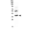 Western blot testing of rat kidney tissue with Il12 p40 antibody at 0.5ug/ml. Predicted molecular weight 37-40 kDa.