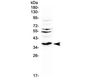 Western blot testing of rat kidney tissue with Il12 p40 antibody at 0.5ug/ml. Predicted molecular weight 37-40 kDa.