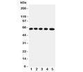 Western blot testing of OCTN2 antibody and Lane 1: rat kidney; 2: (r) skeletal muscles; 3: mouse liver; 4: (m) HEPA; 5: (m) NIH3T3 cell lysate. Expected/observed size ~63KD