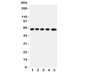 Western blot testing of OCTN2 antibody and Lane 1: rat kidney; 2: (r) skeletal muscles; 3: mouse liver; 4: (m) HEPA; 5: (m) NIH3T3 cell lysate. Expected/observed size ~63KD