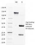 SDS-PAGE analysis of purified, BSA-free Angiotensin Converting Enzyme antibody (clone 9B9) as confirmation of integrity and purity.