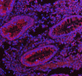 Immunofluorescent staining of FFPE human appendix tissue with HERPUD1 antibody (red) and DAPI nuclear stain (blue). HIER: steam section in pH8 EDTA buffer for 20 min.