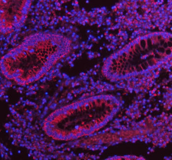 Immunofluorescent staining of FFPE human appendix tissue with HERPUD1 antibody (red) and DAPI nuclear stain (blue). HIER: steam section in pH8 EDTA buffer for 20 min.