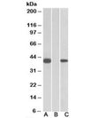 Western blot of HEK293 lysate overexpressing human FANCF-MYC probed with FANCF antibody [1ug/ml] in Lane A and anti-MYC [1/1000] in lane C. Mock-transfected HEK293 probed with FANCF antibody [1ug/ml] in Lane B. Predicted molecular weight: ~42kDa.
