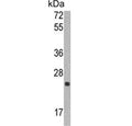 Western blot testing of human CCRF-CEM cell lysate with TIMP1 antibody. Predicted molecular weight ~23 kDa.