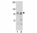 AR antibody western blot analysis in (1) NCI-H292, and (1) NCI-H460 lysate. Predicted molecular weight ~99kDa.