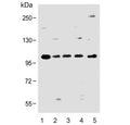 Western blot testing of human 1) SK-BR-3, 2) SH-SY5Y, 3) MCF7, 4) HL60 and 5) rat C6 cell lysate with Protocadherin 20 antibody. Predicted molecular weight ~105 kDa.