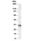 Western blot testing of human bone marrow lysate with DLX5 antibody at 1ug/ml. Predicted molecular weight: ~31kDa.