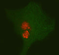 Immunofluorescent staining of PAX3 using anti-PAX3 antibody (red) and anti-Beta Tubulin antibody (green). PAX3 was detected in immunocytochemical section of cell. Enzyme antigen retrieval was performed using IHC enzyme antigen retrieval reagent for 15 mins. The cells were blocked with 10% goat serum. And then incubated with 5 ug/ml rabbit anti-PAX3 antibody and mouse anti-Beta Tubulin antibody overnight at 4oC.
