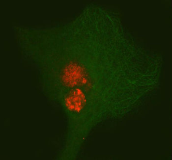 Immunofluorescent staining of PAX3 using anti-PAX3 antibody (red) and anti-Beta Tubulin antibody (green). PAX3 was detected in immunocytochemical section of cell. Enzyme antigen retrieval was performed using IHC enzyme antigen retrieval reagent for 15 mins. The cells were blocked with 10% goat serum. And then incubated with 5 ug/ml rabbit anti-PAX3 antibody and mouse anti-Beta Tubulin antibody overnight at 4oC.