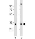 Western blot testing of 1) human skeletal muscle and 2) human heart lysate with TPM3 antibody at 1:2000. Predicted molecular weight: 33 kDa.
