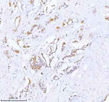 Immunohistochemical staining of PCYOX1 using anti-PCYOX1 antibody. PCYOX1 was detected in a paraffin-embedded section of human testicular seminoma tissue. Heat mediated antigen retrieval was performed in EDTA buffer (pH 8.0, epitope retrieval solution). The tissue section was blocked with 10% goat serum. The tissue section was then incubated with 2 ug/ml rabbit anti-PCYOX1 antibody overnight at 4oC. Peroxidase Conjugated Goat Anti-rabbit IgG was used as secondary antibody and incubated for 30 min at 37oC.