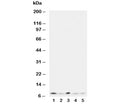 Western blot testing of Ubiquitin antibody and Lane 1: rat thymus; 2: human MCF-7; 3: MM231; 4: HeLa; 5: SMMC-7721 cell lysate.