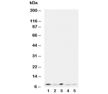 Western blot testing of Ubiquitin antibody and Lane 1: rat thymus; 2: human MCF-7; 3: MM231; 4: HeLa; 5: SMMC-7721 cell lysate.